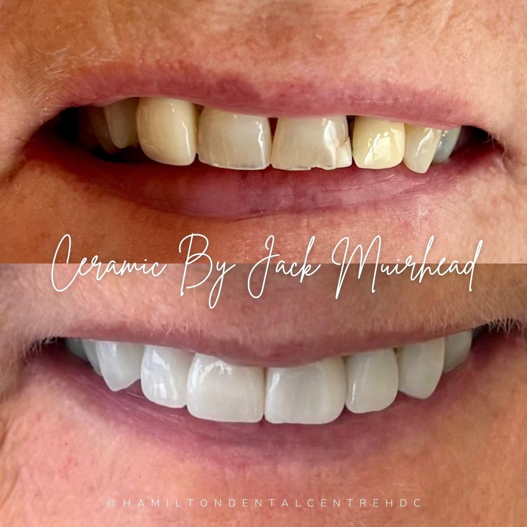 Hamilton Dental Centre Hamilton Dental Centre Hamilton Dental Centre Hamilton Dental Centre