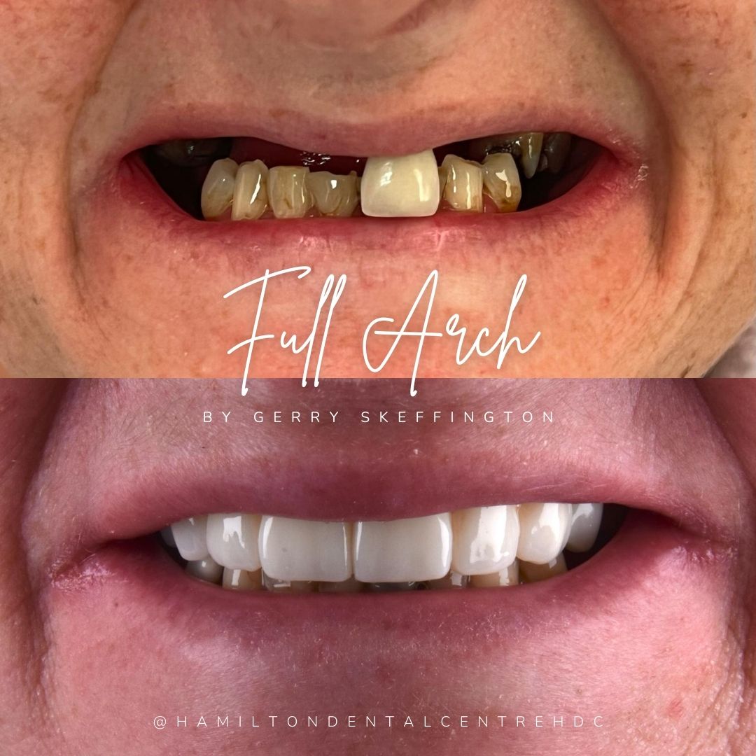 Hamilton Dental Centre Hamilton Dental Centre Hamilton Dental Centre Hamilton Dental Centre