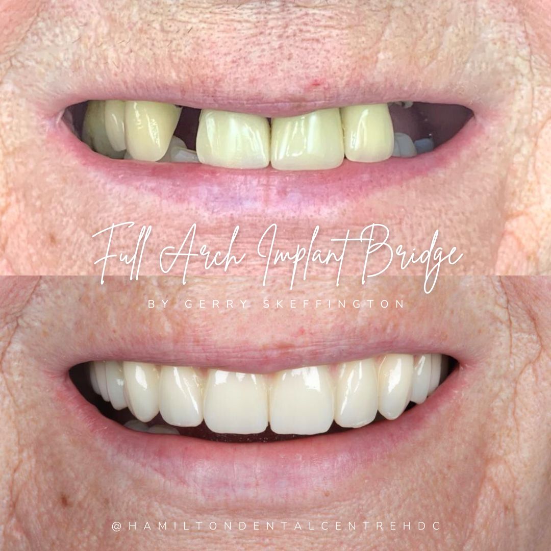 Hamilton Dental Centre Hamilton Dental Centre Hamilton Dental Centre Hamilton Dental Centre