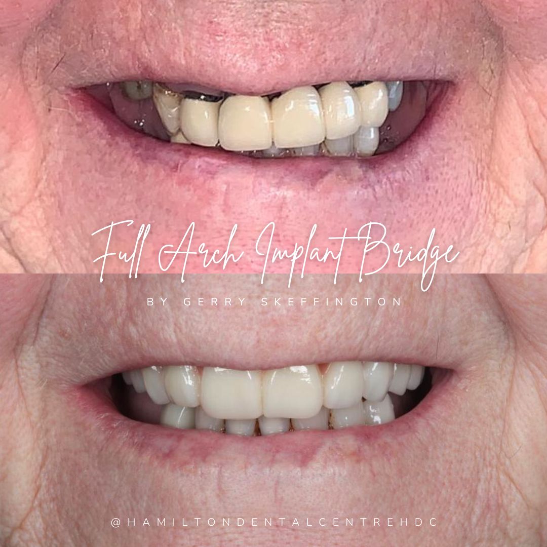 Hamilton Dental Centre Hamilton Dental Centre Hamilton Dental Centre Hamilton Dental Centre