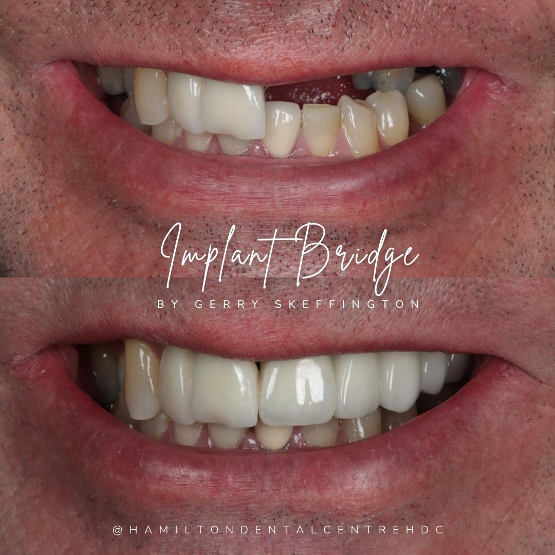Hamilton Dental Centre Hamilton Dental Centre Hamilton Dental Centre Hamilton Dental Centre
