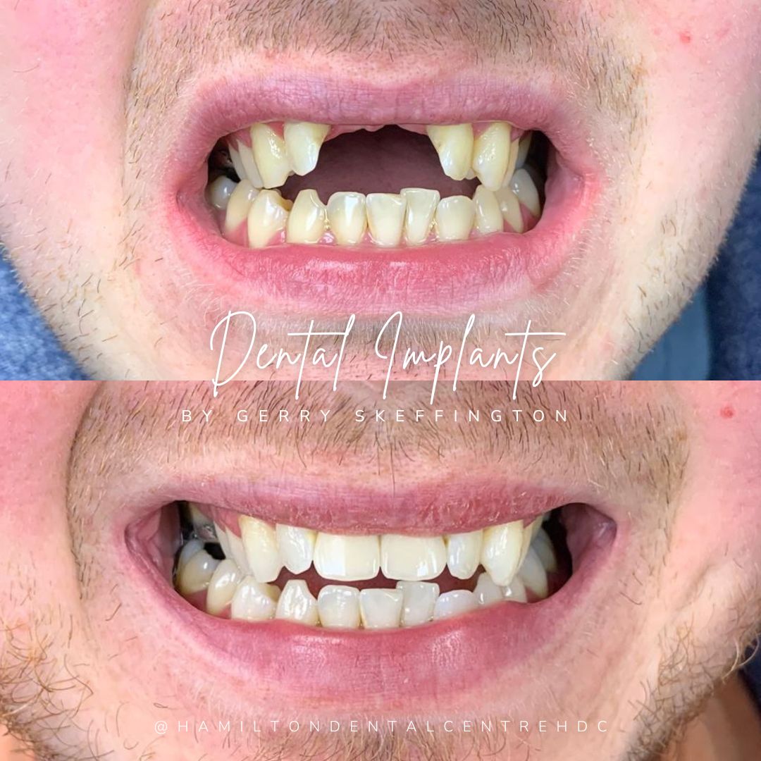 Hamilton Dental Centre Hamilton Dental Centre Hamilton Dental Centre Hamilton Dental Centre