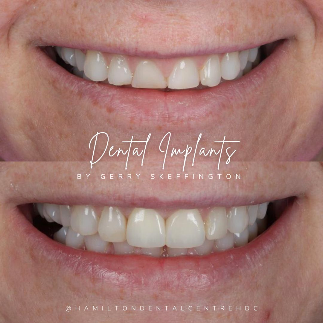 Hamilton Dental Centre Hamilton Dental Centre Hamilton Dental Centre Hamilton Dental Centre