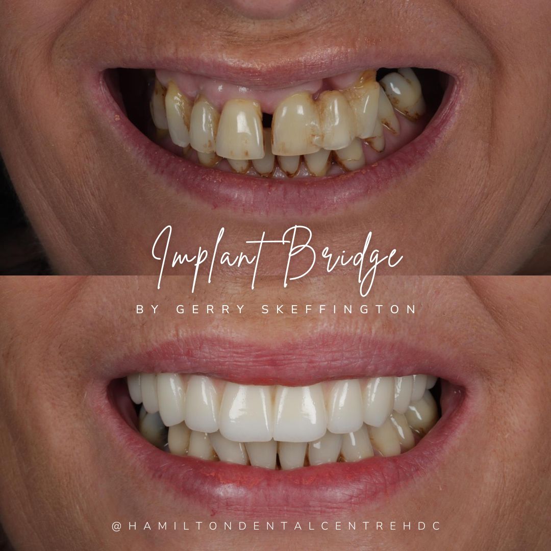 Hamilton Dental Centre Hamilton Dental Centre Hamilton Dental Centre Hamilton Dental Centre