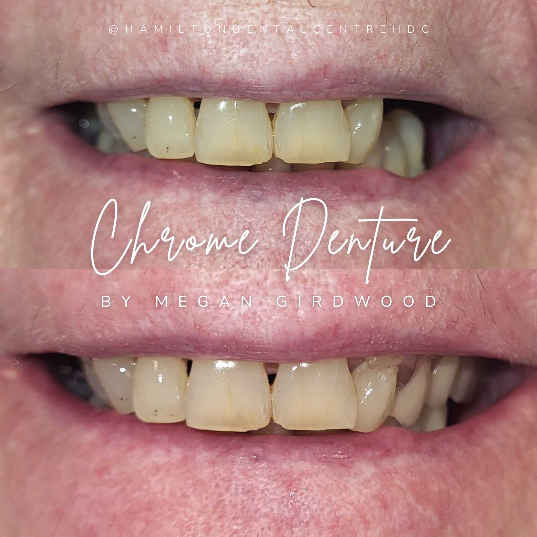 Hamilton Dental Centre Hamilton Dental Centre Hamilton Dental Centre Hamilton Dental Centre