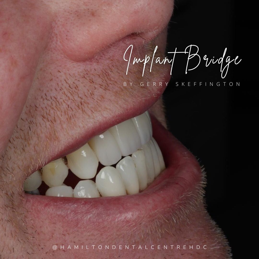 Hamilton Dental Centre Hamilton Dental Centre Hamilton Dental Centre Hamilton Dental Centre